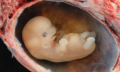 První známky těhotenství po oplodnění