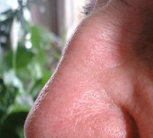 Kvasinky v nose