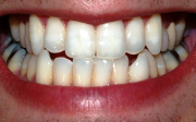 Zubní váček