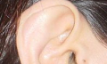 Pískání v uších